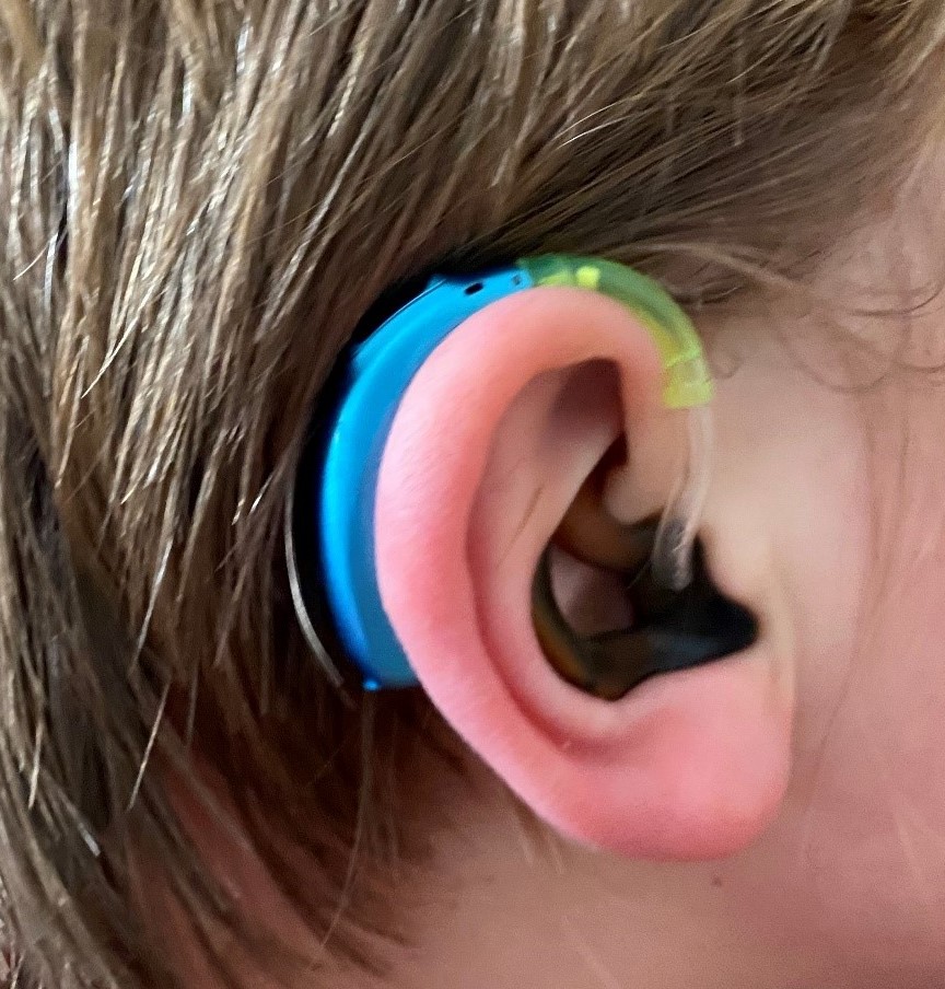 Children's Hearing Aids | Chime Social Enterprise